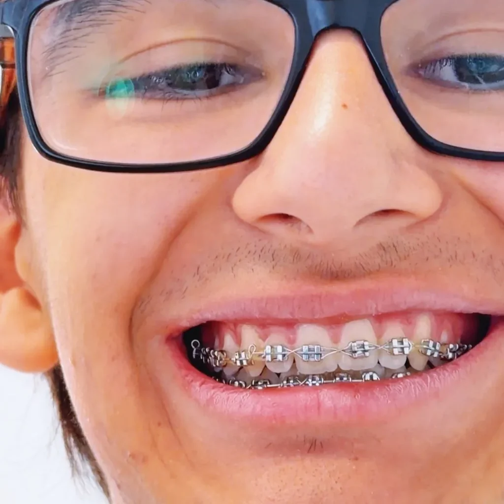 apparecchio dentale a Magenta e Segrate